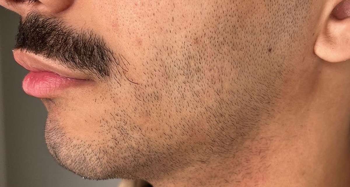 Perfil masculino com barba, antes.